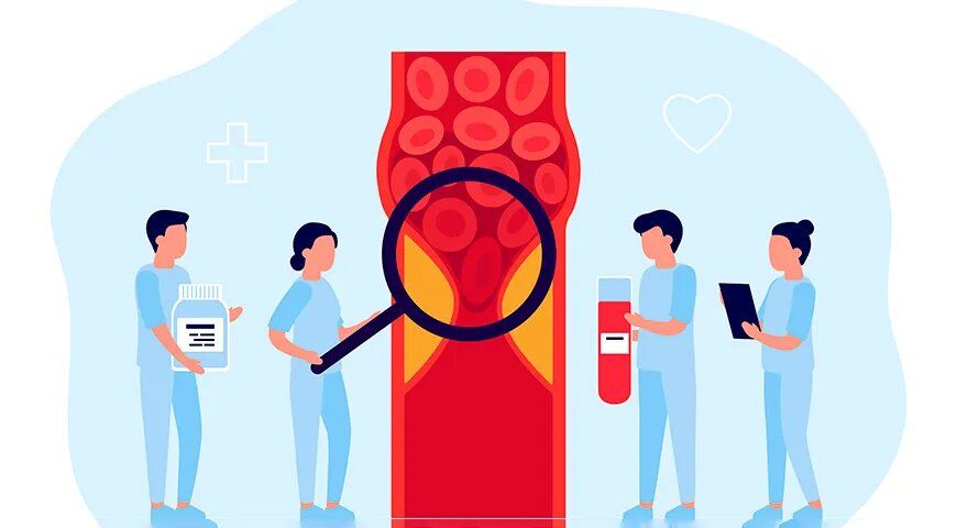 ��� ��������� �������� ��� �������������: ������� ��������� �������